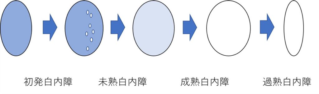 進行の段階